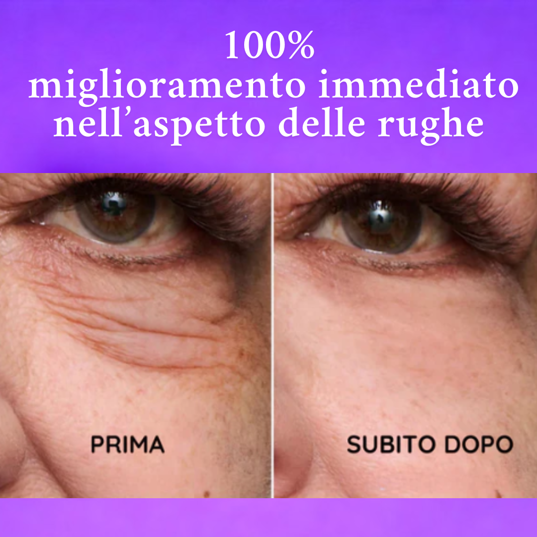 Bellessenza™️ - Crema Rughe Effetto Lifting